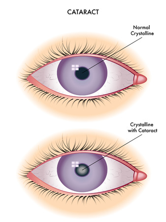 Ophthalmologist near me